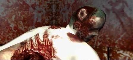 Anomolous body